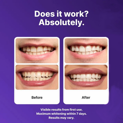 Dr.Purple™ Teeth Whitening Strips