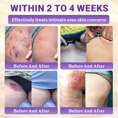 Made and Shipped from Canada ✨Lummvra® Biotin 10-in-1 Skin Restoration Cream