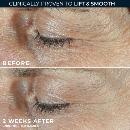 Eye Cream For Face And Neck Retinal, Peptide,Wrinkles, Fine Lines, Aging Skin