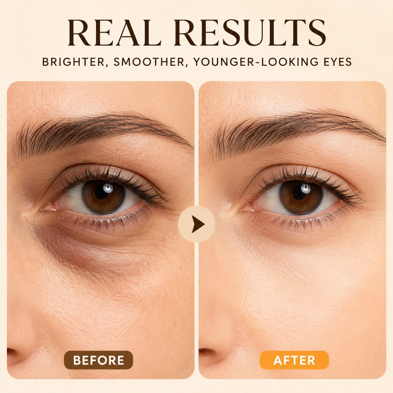 Lummvra™ Firming and Anti- Wrinkle Oil